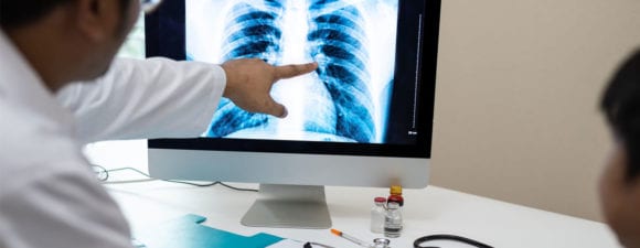 doctor pointing to xray of lungs